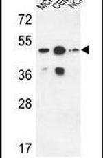 SGMS2 Antibody in Western Blot (WB)