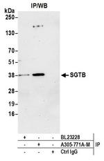 SGTB Polyclonal Antibody