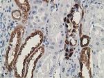 SH2B3 Antibody in Immunohistochemistry (Paraffin) (IHC (P))