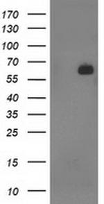 SH2B3 Antibody in Western Blot (WB)
