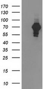 SH2B3 Antibody in Western Blot (WB)