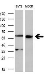 SH2B3 Antibody in Western Blot (WB)
