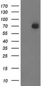 SH2B3 Antibody in Western Blot (WB)