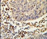SH2D1B Antibody in Immunohistochemistry (IHC)