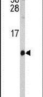 SH2D1B Antibody in Western Blot (WB)