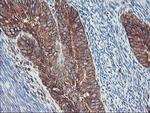 SH2D2A Antibody in Immunohistochemistry (Paraffin) (IHC (P))