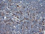 SH2D2A Antibody in Immunohistochemistry (Paraffin) (IHC (P))