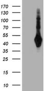 SH2D2A Antibody in Western Blot (WB)
