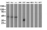 SH2D2A Antibody in Western Blot (WB)