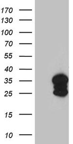SH3BGR Antibody in Western Blot (WB)