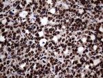 SH3BGRL Antibody in Immunohistochemistry (Paraffin) (IHC (P))