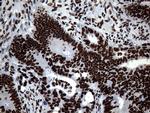 SH3BGRL Antibody in Immunohistochemistry (Paraffin) (IHC (P))