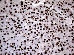 SH3BGRL Antibody in Immunohistochemistry (Paraffin) (IHC (P))