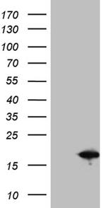 SH3BGRL Antibody in Western Blot (WB)