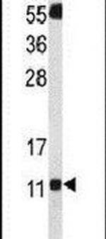 SH3BGRL3 Antibody in Western Blot (WB)