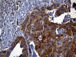 SH3BP1 Antibody in Immunohistochemistry (Paraffin) (IHC (P))