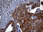 SH3BP1 Antibody in Immunohistochemistry (Paraffin) (IHC (P))