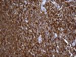 SH3BP1 Antibody in Immunohistochemistry (Paraffin) (IHC (P))