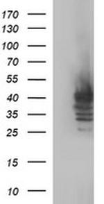 SHBG Antibody in Western Blot (WB)
