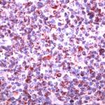 SHIP1 Antibody in Immunohistochemistry (IHC)