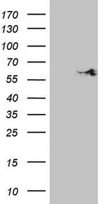 SHMT2 Antibody in Western Blot (WB)