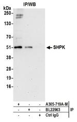 SHPK Polyclonal Antibody