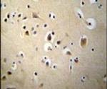 SIAH2 Antibody in Immunohistochemistry (IHC)