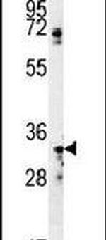 SIAH2 Antibody in Western Blot (WB)