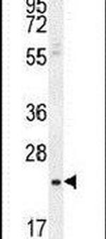SIAH3 Antibody in Western Blot (WB)