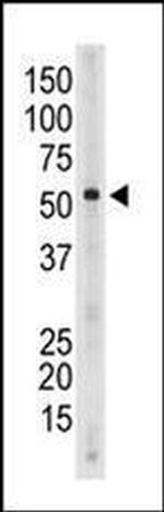SIGLEC6 Antibody in Western Blot (WB)