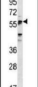 SIGLEC6 Antibody in Western Blot (WB)