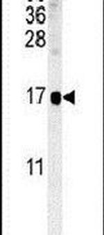 SIKE Antibody in Western Blot (WB)