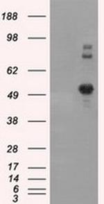 SIL1 Antibody in Western Blot (WB)