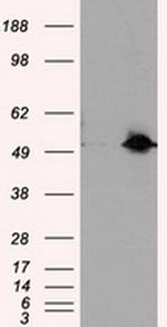 SIL1 Antibody in Western Blot (WB)