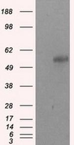 SIL1 Antibody in Western Blot (WB)