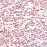 PMEL Antibody in Immunohistochemistry (IHC)