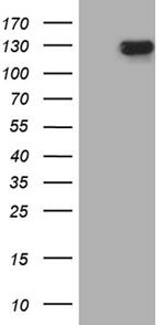 SIRT1 Antibody in Western Blot (WB)