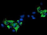SIRT5 Antibody in Immunocytochemistry (ICC/IF)