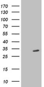 SIRT5 Antibody in Western Blot (WB)