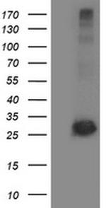 SIRT5 Antibody in Western Blot (WB)