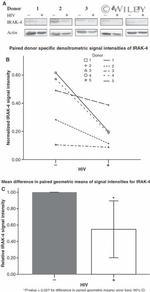 IRAK4 Antibody in Western Blot (WB)