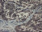 SKIL Antibody in Immunohistochemistry (Paraffin) (IHC (P))