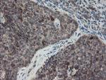SKIL Antibody in Immunohistochemistry (Paraffin) (IHC (P))