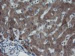 SKIL Antibody in Immunohistochemistry (Paraffin) (IHC (P))