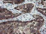 SKIL Antibody in Immunohistochemistry (Paraffin) (IHC (P))