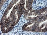 SKIL Antibody in Immunohistochemistry (Paraffin) (IHC (P))