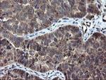 SKIL Antibody in Immunohistochemistry (Paraffin) (IHC (P))
