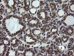 SKIL Antibody in Immunohistochemistry (Paraffin) (IHC (P))
