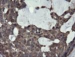 SKIL Antibody in Immunohistochemistry (Paraffin) (IHC (P))