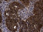 SKIL Antibody in Immunohistochemistry (Paraffin) (IHC (P))